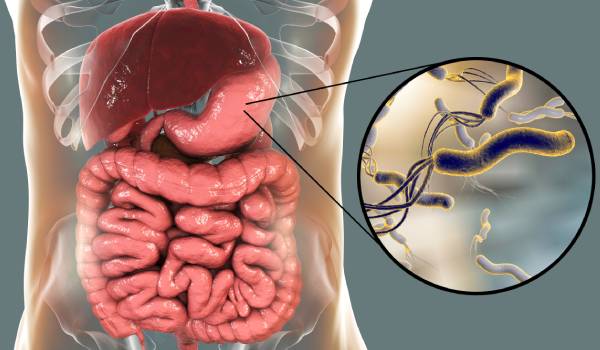 طرشي لعلاج جرثومة المعدة , التخلص من جرثومة المعدة