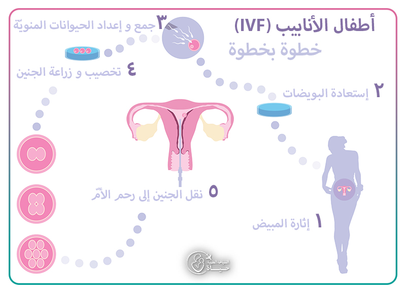 تحفيز البطانه قبل البدء بعملية اطفال الانابيب تمنع الدردشة